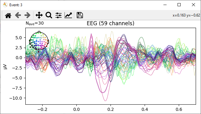 evoked potentials event 3