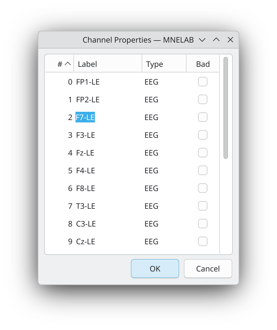Renaming individual channels